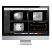 Software solutions for miniscope, neuron cells imaging